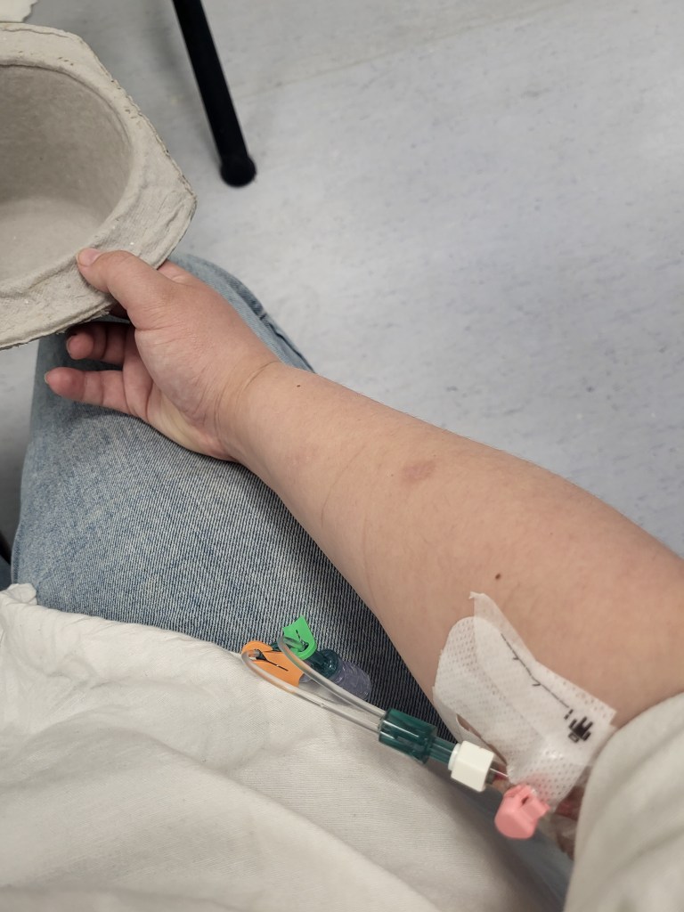 An image of Rosie's arm with a cannula in it. Her hand is holding an empty sick bucket. 